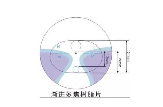 美麗島多焦鏡適合的人群,，需要注意的事項